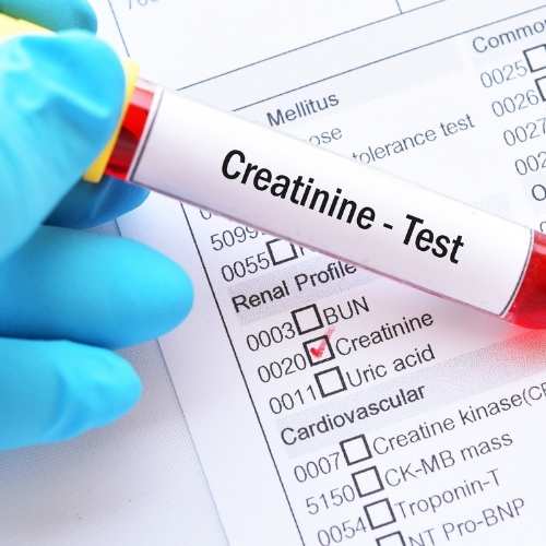kidney-test-in-blood