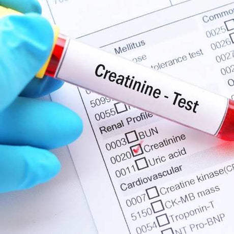 kidney-test-in-blood