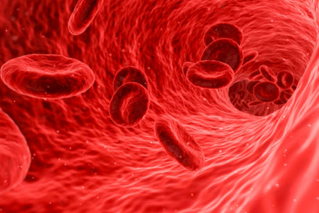 What are the causes of iron deficiency anemia? - Medasia.Store