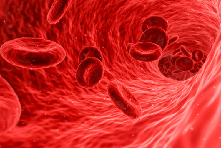 What are the causes of iron deficiency anemia? - Medasia.Store