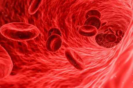 What are the causes of iron deficiency anemia? - Medasia.Store