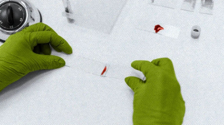 What tests can diagnose iron deficiency anemia? - Medasia.Store
