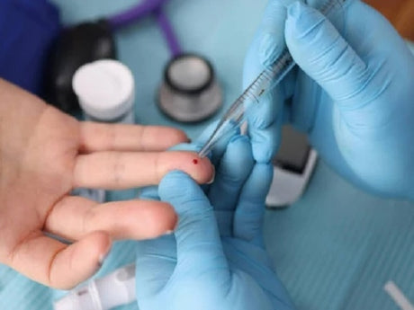 How hemoglobin is measured?