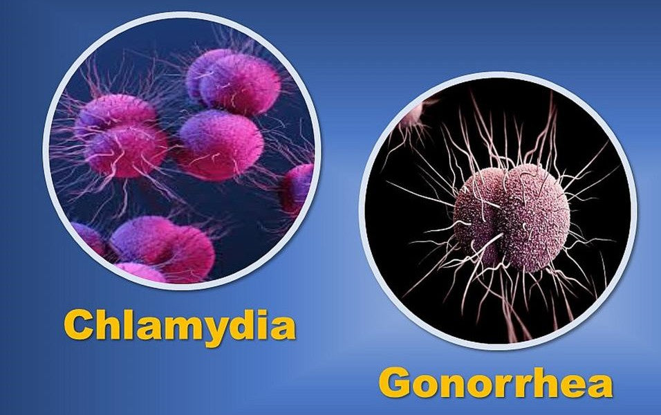 Chlamydia and Gonorrhea: most common STIs