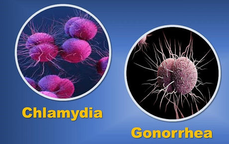 Chlamydia and Gonorrhea: most common STIs