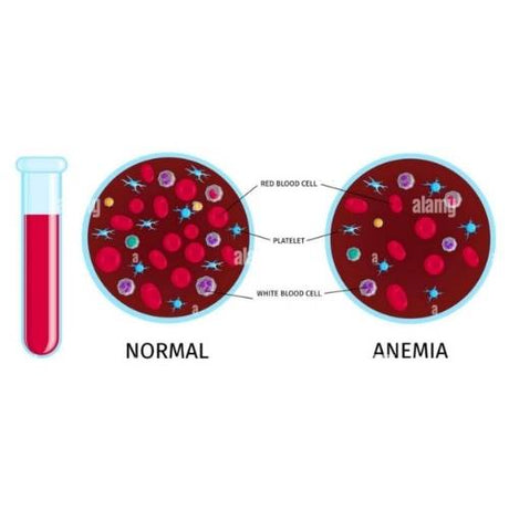 Get a Necessary Anemia Test