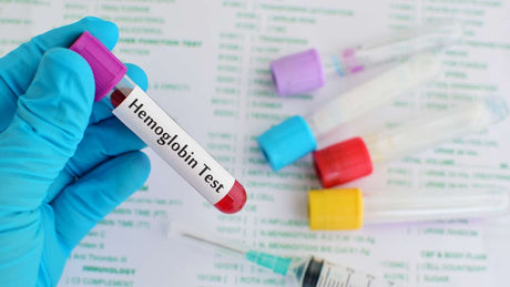 Hemoglobin test for results