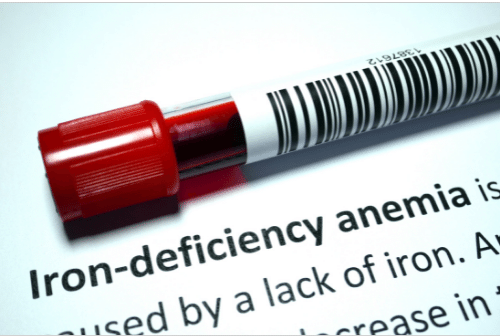 How do you manage your iron deficiency anaemia?