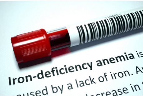 How do you manage your iron deficiency anaemia?