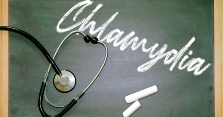 Understanding Gonorrhea and Chlamydia: What You Need to Know