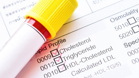 Watch Your Lipids, Boost Your Life!