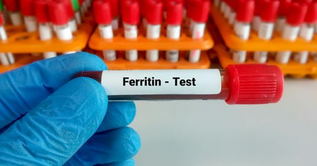 Blood Test for Iron: What It's Called, What It Measures & How to Test at Home