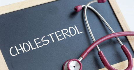 Warning Signs You Might Have High Cholesterol – Don't Ignore These Symptoms！