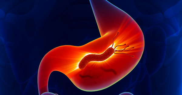 How Helicobacter pylori Impacts on Your Stomach