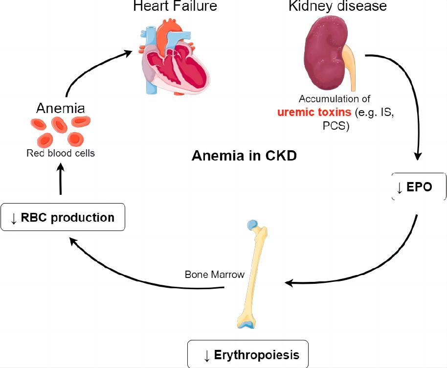 Navigating the Link Between Chronic Kidney Disease and Hemoglobin