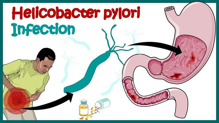 Can Helicobacter pylori be serious?