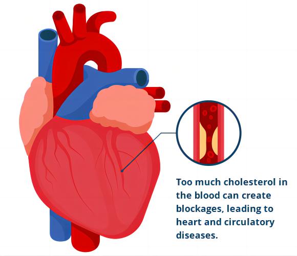 Understanding Cholesterol Testing: How to Choose the Best Test for Your Health