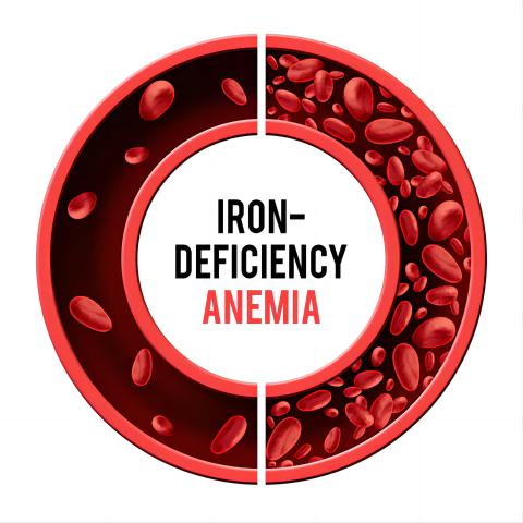 From Iron Deficiency to Hypertension: Understanding the Relationship between Anemia and High Blood Pressure