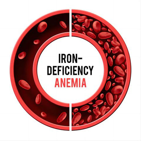 From Iron Deficiency to Hypertension: Understanding the Relationship between Anemia and High Blood Pressure