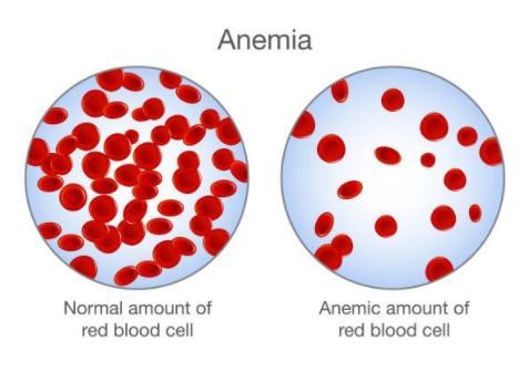 How do I know if I'm anemic? - Medasia.Store