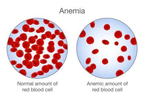 How do I know if I'm anemic? - Medasia.Store