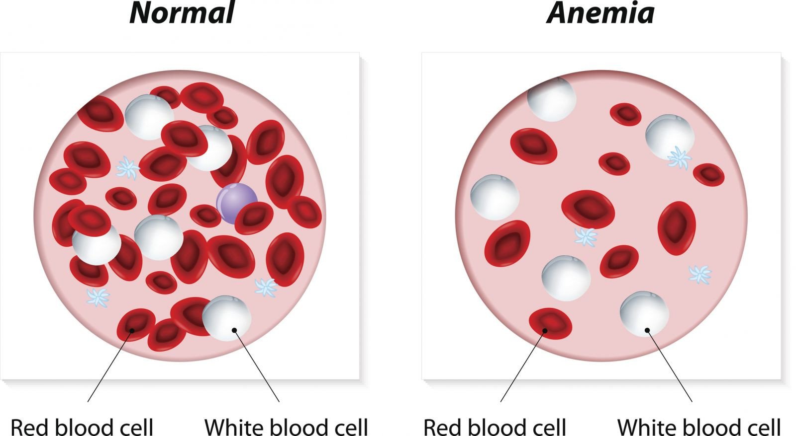 Are hemoglobin test meters suitable for home use?