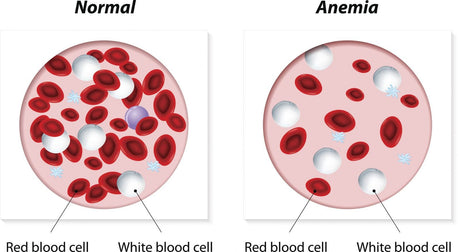 Are hemoglobin test meters suitable for home use?