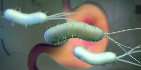 Is Helicobacter pylori a risk factor for gastric cancer?