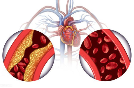 Why is diabetes prone to vascular disease? - Medasia.Store