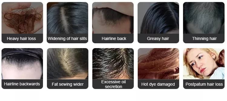 7-in-1 RF & Laser Hair Regrowth Comb – EMS, Red Light & Vibration Scalp Stimulator