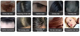 7-in-1 RF & Laser Hair Regrowth Comb – EMS, Red Light & Vibration Scalp Stimulator